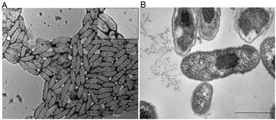 Identification of Electrode Respiring, Hydrocarbonoclastic Bacterial Strain Stenotrophomonas maltophilia MK2 Highlights the Untapped Potential for Environmental Bioremediation